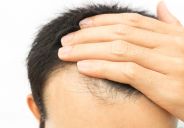 trapianto di capelli